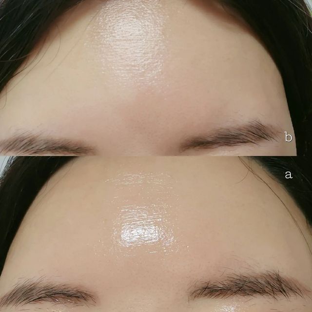 재테크하는 웹디자이너 on Instagram: "#광고 탄력없이 늘어지는 피부 쳐지는 피부는 콜라겐이 부족해서 나타나는 현상 ㅠㅠ! ⠀ 콜라겐 화장품은 흡수력과 함유량이 중요한데 메디큐브 콜라겐