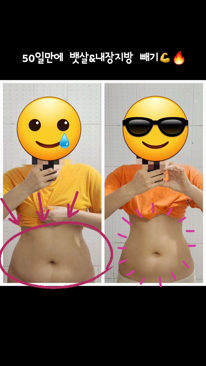 50일만에 뱃살&내장지방 빼기💪🔥
-
PT 2회만에 어깨 통증 없애기!🙂
-
런트쌤과 함께 다이어트&통증완화 가시지요🏃‍♂️🏃‍♀️
-
-
-
건강운동관리사 런트쌤😄