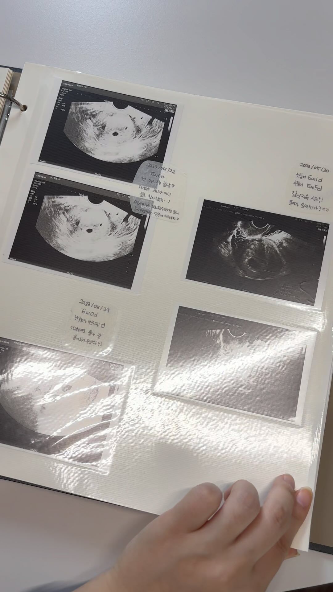#남매둥이 

오랜만에 아가들보러
아산병원행👶🏻👶🏻

병원에서 준 초음파사진은
뭔지 정체를 알수 없음으로
초음파사진 정리한걸로오

#29w0d 
1.2kg으로 아주 잘크고 있다니
기특하네 둘다❤️❤️

앞으로 남은 7-8주도
아무탈없이 잘 지내자🤰🏻

#8개월임산부 #쌍둥이임신 #둥이임신 
#막달임산부 #막달검사 #아산병원산부인과