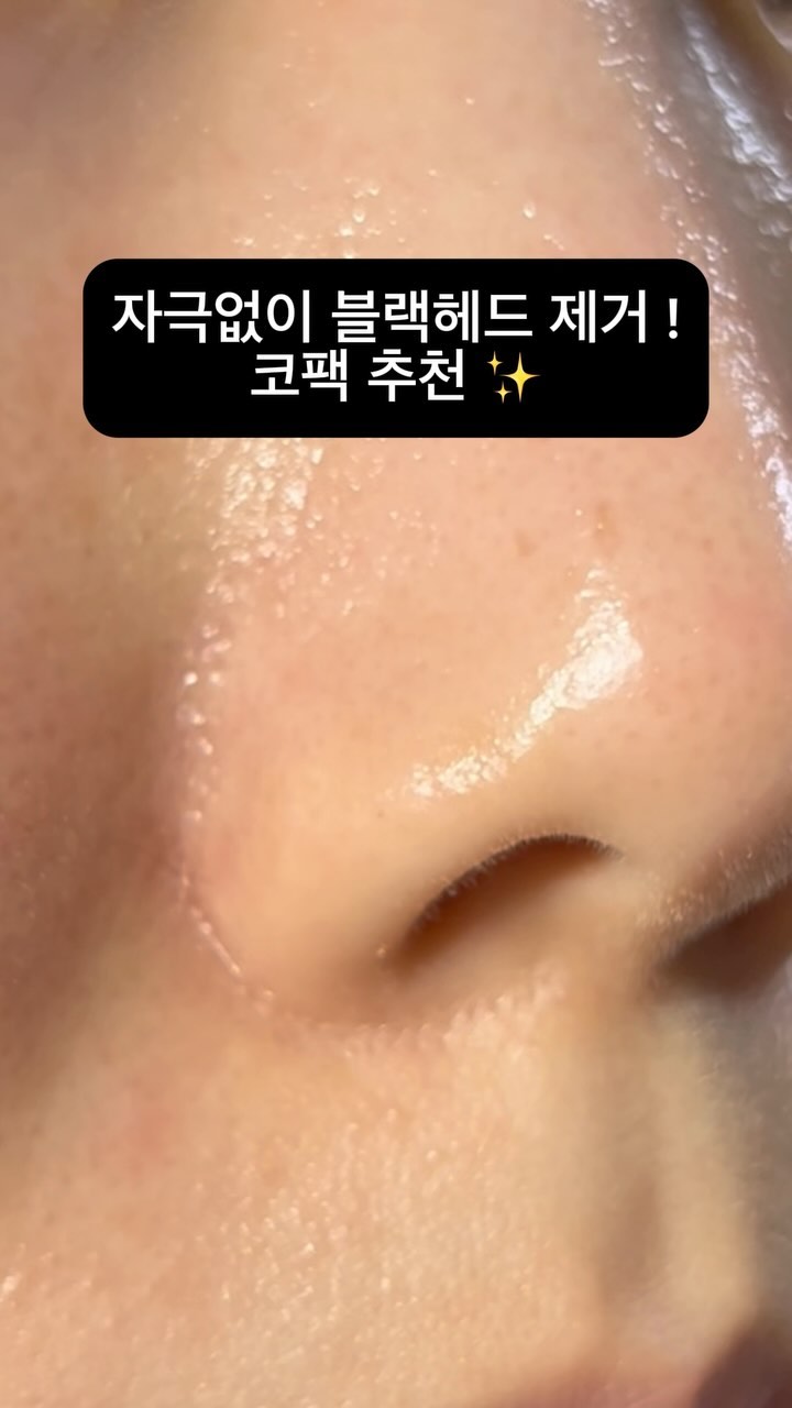#협찬

뜯거나 뽑는 코팩이 무서워서 한 번도 안 해본 사람 손 🙋🏻‍♀️

마스크팩 1등 ! #메디힐 ⭐️
’메디힐‘에서 만든 코팩이라 믿고 사용해 봤어요 ☺️

STEP 1 - 피지 연화
STEP 2 - 듀얼 피지 스패출러
STEP 3 - 모공 수렴

피지를 불리고 > 전용 스패출러로 피지 제거 > 모공 닫기

이 3단계만 따라 하면 끝 ✨ 참 쉽죠잉 😎

‘메디힐’에서 개발한 ‘듀얼 피지 스패출러’ !
이게 코팩의 핵심이라 할 수 있어요 😁

‘와이드형’ - 모공 밖으로 올라온 피지를 닦아 주고,
‘스팟형’ - 깊은 블랙헤드와 작은 모공 집중 타겟 !

아프지 않고, 슥슥 - 닦아 주기만 하면 돼요 👍🏻

얼굴 골격에 최적화한 105mm ‘와이드 시트’
코뿐만 아니라 모든 피지 고민 부위에 사용 가능해요 ☺️

지금 #빤쮸토끼 X #메디힐코팩 콜라보 중이라
‘빤쮸토끼’ 대왕 스티커 2개 득템 기회까지 ! !

#빤쮸토끼코팩 관심 있는 분들 공식몰로 달리세요 💨

#코팩추천 #코팩 #블랙헤드멜팅클리어코팩