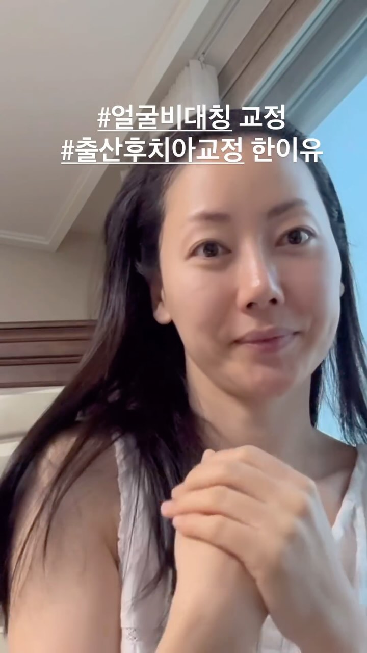 #안면비대칭교정 출산후 #치아교정 #급속교정  두번의 자연분만 으로 
치아하나가 출산후 점점 더 누어 
완전히 비틀어 지더라구요 
나이탓? 일수있지만, 
치아하나로 
#입꼬리비대칭 #안면비대칭 #얼굴비대칭 까지 신경이쓰여서 
도움을받았던 #정바른자세연구소 #골근위뷰티 그리고 #튤립잔스 #치아교정 (아래만급속교정)  많이 개선 되는중 입니다 (지금도 ing)  p.s 몸의 발란스교정 하는 #필라테스원장출신 👀안비밀👀