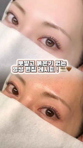 붉은기 𝐙𝐞𝐫𝐨! 영상 보정 기본 레시피 -💝
영상 색감이 아쉬웠던 원장님들 꼭 한번 따라해보세요 :) .ᐟ.ᐟ 

1. Meitu 어플에서 동영상 불러오기! - 동영상 리터칭 클릭
2. 자동 - 달빛 - 메이크업0 (나머지는 기본값)
3. 메이크업 - 눈 - 콘텍트렌즈 - Crescent
4. 얼굴볼륨 - 이마 & 눈썹아치
5. 피부 - 윤기 - 하이라이트20 - 컨실러33
6. 눈 - 다크서클0 - 밝게55 - 세부내용0 - 공막65

#사진 #사진보정 #영상보정 #영상보정법 #산본속눈썹펌 #산본속눈썹 #범계속눈썹펌 #안양속눈썹펌 #영상편집 #영상제작 #사진보정법