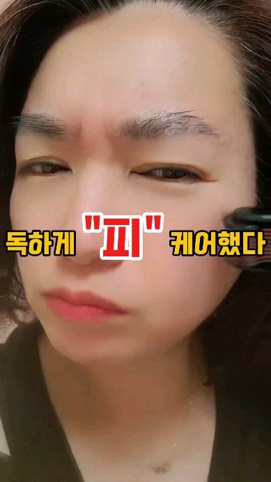 1회용인거만 믿고 울면서 피 케어했다
 
일주일에 하나씩 쓴다해도 한달이면 *4
1년이면 50개 가까이가 필요하다 ㄷㄷㄷ
 
글고 진짜 진짜 느므느므 아프다ㅠㅠ 
눈물찔끔 ㅠ 피도 찔끔
그래서 자꾸 미룬다^^;;;ㅋㅋㅋ
 
하지만, mts를 포기할 수는 없었다
그래서 바꿨다!!
 
✔️루비클 mts 롤러!!
 
1도 안아프고 홈케어 제품들 흡수 쫙쫙!!
드르륵 드르륵 뭉친부분은 라인도 예쁘게 잡아준다
 
무엇보다 100% 아연합금!! 
반영구적 사용 가능하다!!
 
녹에 강하기에 사용후 씻어서 말리면 된다! 
 
======================================
 
저처럼 무식하게 참지마세요🤣
루비클로 편하고 스마트하게 mts 하세요!! :)
 
 
#광고 #MTS롤러 #MTS #MTS홈케어 #페이스롤러 #얼굴롤러 #MTS0.25 #니들롤러 #마사지롤러 #MTS롤러0.25 #더마롤러
 

@rubicle_official
