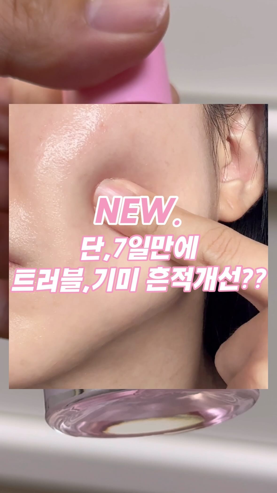 -
#ad #에이프릴스킨앰버서더 
@aprilskin_korea 

요즘 핑크알로에 스킨케어로 
밀고 있는 에이프릴스킨에서 
또 핑크알로에라인 스킨케어를 출시했다????💖

17일 오늘 오전 10시에 오픈해서 
판매가 시작된 트러블,잡티,기미 흔적개선 세럼!!!! 
NEW.핑크 알로에 뮤신세럼 출시” 🎀

단,7일 사용으로 트러블,잡티,기미 등
지저분한 흔적을 개선시켜준다는 
신박템이 에이프릴스킨에서 등장했습니다!

쭈-욱 늘어나는 실타래제형부터 
신기했는데 이게 완전히 흡수가 되면
끈적이지 않고 산뜻하게 흡수가 되는게 
수부지피부에 쓸만하더라구요!💖

여름이 되면 워낙 홍조랑 붉은기가
많이 일어나는 피부라서 
요런 진정제품 잘 쓰고 있었는데 

일반 알로에 대비 198% 진정 성분이 
더 높은 핑크 알로에 78%가 함유된 
핑크알로에 뮤신세럼이 트러블,잡티,기미 흔적까지 
케어해준다고 하니 꾸준히 쓰면 
깨끗하고 예쁜 유리알 광채피부 관리에 도움이 되겠져??

저자극테스트도 완료하고 
여드름성 피부에도 사용이 적합한 제품이라서
트러블 잘 나시는 분들도 
편하게 써볼 수 있을 거 같아요!

요즘 점점 뜨거워지는 자외선 때문에 
잡티,기미도 눈가주변에 많이 올라오고 있어서
저는 주로 핑크알로에 뮤신세럼을 
눈가 주변으로 자주 써보고 있어요💖

원래 쓰고있던 핑크알로에토너랑
같이 사용한다면 홍조나 트러블 흔적없이 
깨끗한 피부를 유지하는데 도움이 되지 않을까 싶어서
요즘 같이 잘 써보고 있는 중이에요!

지금 여행이 많은 계절이니
더 뜨거워질 자외선에 대비해서 
요런 흔적세럼 자주 챙겨보렵니다!!!💖
.
.
.
#제품협찬 #핑크알로에 #핑크알로에뮤신세럼 #흔적세럼 #광채세럼 #뮤신세럼 #미백세럼 #알로에 #진정세럼 #비타민세럼 #세럼추천 #미백화장품 #알로에화장품 #피부진정 #흔적케어 #잡티관리 #기미관리 #붉은기진정 #진정화장품 #기미잡티 #유리알피부 #깨끗한피부 #스킨케어 #홈케어 #홈케어추천 #aprilskin #aprilskinkorea