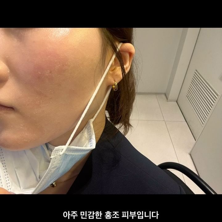 #협찬 @zigtag.official 

제품명: ZIGTAG 테카 마이크로 버블 앰플 토너

머리카락 보다 무려 500배 작은 병풀 캡슐이 피부 속까지 빠르게 침투해 깊은 진정 효과를 주는 앰플 토너를 가지고 왔어요~! 3번 더 잘게 쪼갠 병풀 TECA 성분이 자극 없이 빠르게 피부에 침투하며, 판테놀과 징크, PHA  성분이 울퉁불퉁한 각직과 피부결까지 매끄럽게 만들어 줍니다.

무자극 테스트 완료! 자극 없이 순하게 사용이 가능했어요. 손에 닿는 순간 터지는 수분 버블로 피부에 폭발적인 수분감 공급으로 여러 스킨 단계가 귀찮았던 분들은 토너와 앰플을 한번에 해결이 가능해요. 한번만의 사요으로도 촉촉, 탄탄해진 피부로 탄생 가능해요. 매끄럽게 각질 정돈이 된 피부결이 예술이었어요~

빠르게 흡수되어 끈적임 없는 산뜻한 마무리감이 좋았어요. 민감성 피부를 가진 분이라면, 토너를 사용한 후 자극 없이 편안한 피부 상태를 보실 수 있을겁니다. 후 관리 크림이 부드럽게 발리고, 흡수 하느라 피부에 자극을 주지 않았어요. 피부가 거칠거나 건조한 부분에 토너를 여러 번 덧발라주시면 더더욱 촉촉하고 건강해진 피부를 보실 수 있으실 겁니다~!
•
•
•
#테카마이크로버블앰플토너 #수분템 #진정템 #나노병풀 #판테놀 #토너 #앰플 #직택 #지그태그 #zigtag #fashionderam #기초화장품추천