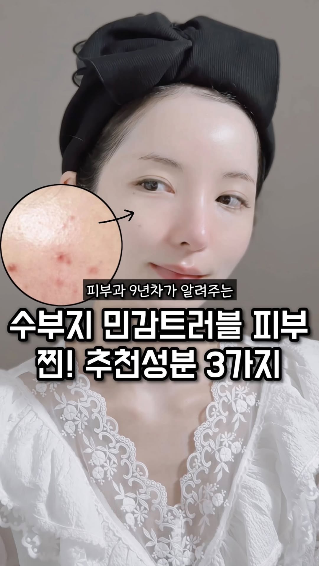 📌수부지 민감트러블피부에 찐 추천성분 3가지
⠀⠀
수부지 여러분 혹쉬 !!!!!!!!!!!
✅계절마다 너무 잘 뒤집어진다.
✅트러블을 달고산다.
✅얇고 예민하다.
✅유분감도 많은데 속은 또 건조하다.
✅기초유목민이다.
⠀⠀
✋🏼지금 어? 이거 내 이야기아니야 ?? 하시는 분들 계시죠 !!!???
✋🏼그렇다면 딱 20초만 시간내서 마지막까지 확인해주세요 !
⠀⠀
⠀⠀
피부관리에 있어서 가장 기본이되는
”수분+진정“ 관리에요🐳
⠀⠀
수부지 민감트러블피부에 효과본 
찐 추천성분 3가지 알려드릴게요
1️⃣재생력이 뛰어난 부활초
2️⃣유수분 밸런스와 무너진 장벽을 튼튼하게 판테놀 
3️⃣정제수 대신 병풀잎 추출물
⠀⠀
점점 피부가 편안해지는게 느껴지구요☺️
추가로 어떤팩을 하더라도 만족감이 달라져요‼️
⠀⠀
온갖 팩, 고기능성제품들 많이 사용하고 있지만
막상 기초제품은 이거쓰다 저거쓰다가 한다면
”부활기초라인“ 으로
꼭 피부 기본부터 탄탄하게 잡아주세요🙆🏻‍♀️
⠀⠀
⠀⠀
🔻🔻🔻
피부의 기본인 수분+진정관리가 안되어잇으면
어떤 피부고민이든
제대로된 효과를 보기가 어려워요..🥺
⠀⠀
저도 여러가지 팩, 기능성제품들을 진행하지만
기본이 안잡혀잇는경우
첫번째로 추천하는게 부활기초라인이거든요🫶🏼
⠀⠀
그리고 울 바비님들을 위해 돌아온⚠️마지막 앵콜진행⚠️
바비윤 데일리루틴의 핵심 !!!
제 피부 기초공사 1등 공신인 !!
⠀⠀
< 부활기초라인 + 콜라겐크림 + 페이스타올 >
지금 역대급 구성과 이벤트로 진행중이에요 !!!!!
⠀⠀
❗️바비윤 단독구성❗️으로
⭕️오직 바비님들을 위해서 준비한 이벤트라구요 !!!!!!
⭕️최대 𝟱𝟭% 할인율과 어디서도 볼수없는 최대혜택
⭕️일년 중 1-2번 잇을까 말까한 그런 구성이에요 !
⭕️놓치면 내년 후반까지 1년은 더 기다려야 해요 !
⠀⠀
⠀⠀
🎁 지금 단독구성🎁
부활기초라인&콜라겐크림&페이스타올 2+1, 6+7
⠀⠀
1️⃣SET구성 (부활토너2+부활앰플2+부활크림2) 구매시
부활토너+부활앰플+부활크림+콜라겐크림+선크림+미스트용기+페이스타올까지 전부 다
6+7 으로 드립니다 ???😎
(4-5개월은 맘 푹 놓고 쓸수잇음)
2️⃣전제품 2+1
3️⃣페이스타올 최최최저가
4️⃣전 구매고객 샘플 증정
⠀⠀
✋🏼역대급 빅 이벤트 맞죠 ??????
✋🏼이번에 놓치면 또 언제 이 구성을 만나볼수있는지 몰라요......🥺
⠀⠀
유통기한은 모두 넉넉한 제품이니까
미리미리 꼭 챙겨주기에요오 ?????
⠀⠀
✔️제품별 유통기한
부활토너: 2027.07.07
부활앰플: 2027.04.23
부활크림: 2026.08.29
콜라겐크림: 2027.05.23
선크림: 2027.01.17
⠀⠀
지금 @hayoonson_
프로필링크에서 구매 가능해요❤️
⠀⠀
.
.
.
#꿀팁공유 #스킨케어 #기초화장품 #피부진정 #에스테틱화장품 #피부홈케어 #기초화장품추천 #스킨케어추천 #홈에스테틱 #트러블케어 #민감피부 #기초케어 #피부염 #아말다 #피부관리법 #속건조 #수분 #피부좋아지는법 #홈케어