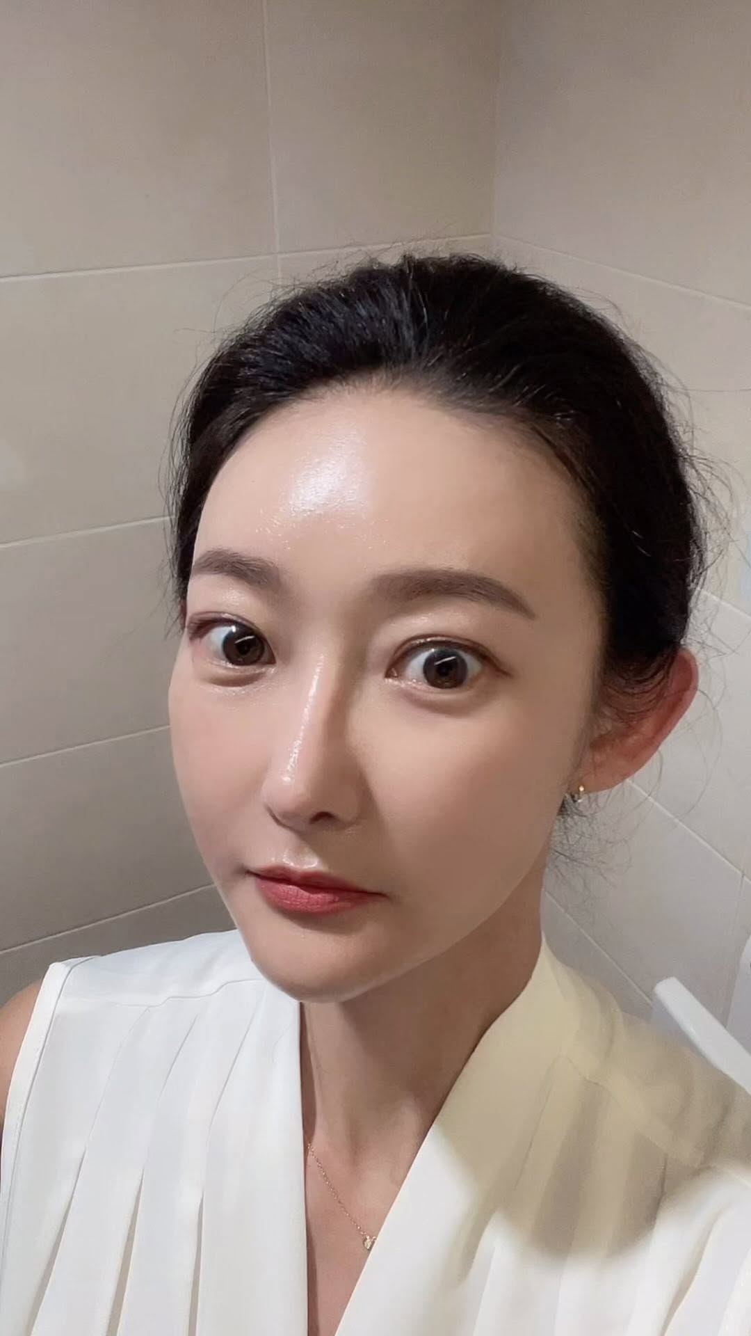 나..오랫만에…일하러 나왔는데…(몇 년만의 킨텍스던가~~~) 

눈다래끼 무슨일이야 ㅠ ㅠ 

빠마 머리는 무슨일이야😛

필로르 맞고 회복됐다 좋아했는데 갑자기 눈다래끼나고 항생제 먹어도 안나아서 안과 갔더니 째서 빼야된다며…

병원도 못가고 일하러 나옴. 

그래도 피부는 많이 밝아지고 결이 부드러워졌다. 

리주란이랑 같은 효과 볼 수 있다 해서 아플줄 알았지만 안 아팠다는거~~~참을만하니까 다들 도전해 보셔도 될거 같아요~~~

원장님께서 원하는 부분, 필요한 부분을 보시면서 손으로 한땀 한땀 잘 놓아주셔서 엠보도 심하지 않았지만 피가 좀 나서 멍은 며칠갔다. 피부 얇은 탓일까 ㅡ ㅡ 

제발 환절기에 건조하지 않고 수분감 있게 지나갔으면 좋겠다~

병원도 컬러풀하니 대기시간이 지루하다는 느낌이 없이 눈 둘 곳이 많았고, 커피랑 주스까지 있어서 야금야금 입채우기도 바빴다 🤗

#여자는돈이야 #필로르 #스킨부스터 #쁨신논현 #수분촉촉 #강남피부과 #daily #skinbooster #followforfollowback