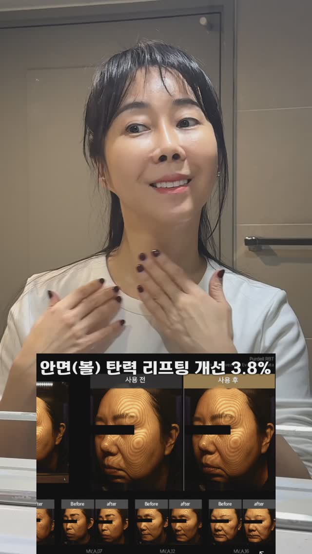 #광고

🏷️퍼델 알비티 안티에이징 세럼

제가 나름 관리의 여자이잖아요.
얼굴은 쳐질까봐 디바이스기기도 많이하고 
좋은화장품, 레이저, 맛사지 많이 했는데 
목주름은 거의 관리를 못했어요.

그러다 요즘 알게된 퍼델 세럼을 열심히
목주름 안생기려고 발라보았답니다♥️

<퍼델 알비티 안티에이징 세럼 이런 분들께 추천합니다>

✔️피부 잔주름으로 고민이신분
✔️피부가 건조하고 탄력이 떨어지신분 
✔뭘 발라도 피부가 거칠고 힘이 없다고 느끼시는 분
✔️전체적인 피부처짐으로 리프팅케어를 원하시는 분

프리미엄 에스테틱을 Purdell RBT 하나로 경험해보세요✨

.

#퍼델 #목주름 #목주름세럼 #purdell
#퍼델알비티안티에이징세럼 #주름세럼