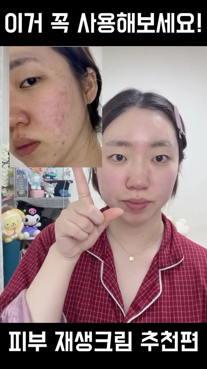 #광고

여러분 제가 제일 좋아하는 애사비+율무 조합의
재생크림 가져와봤는데요!

평소에 정말 잘 쓰고 있던 1인으로써 
너무 영광이네요 ㅋㅋ🥰

여거 성분 배합 진짜 완전 꿀조합이구용🩵

특히 피부 재생이 필요하신 분 요거 강력 추천!!
근데 요즘에눈 나이가 나이인지라 탄력크림을
찾고계시다면? 바로 애나비 크림 사용해주기!

애나비 크림이 재생+미백+주름+탄력 에 좋은거
아시죠? 모르는 사람 없을꼬에요☺️

이거 약국에서도 정말 핫한데 
또 이렇게 좋은 기회가 찾아와 주어서

너무 좋으네요 ㅎㅎ

자세한 설명은 아래 ⬇️ 참고부탁드려용

✅약국 품절 역대급 결개선크림
✅애쓴 당신의 피부, 나만의 비밀 솔루션
✅피부과 전문의 감독 하 테스트 완료
✅3중 인체적용 테스트 완료
✅재구매율 92%
✅불만족시 100% 환불
✅시중판매하는 율무씨수 중 최대 함량 604,000PM

그럼 후기는 여기까지~!
오늘도 끝까지 봐주셔서 감사해요!💖

#애나비크림#쥐젖크림#편평사마귀크림#쥐젖제거크림