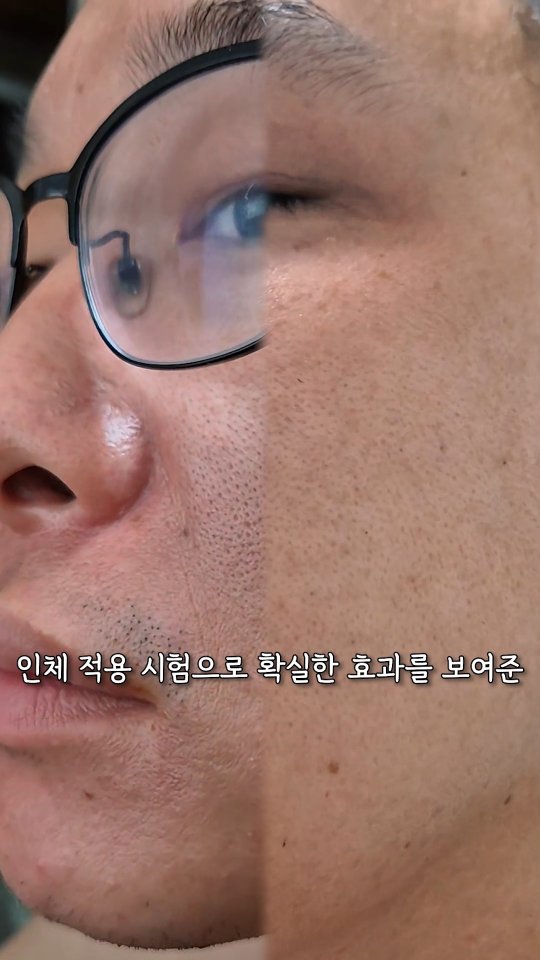 #광고 조금만 긴장 풀면 모공이
확 넓어지면서 훅 늙기 쉬운 30대...🥲
관리 정말 빡세게 해야 하는데
남편 특 : 사다 바쳐도 1도 안씀 ^^;
뷰티 디바이스는 번거롭고, 팩은 귀찮고
관리하기 힘들다고 징징징~ 그럴 때는
복잡하게 바르고 따로 더 할 것 없이
바로 흡수시키면 끝인 #스피큘앰플 이 답!!
#일시적모공축소 효과로 가로/세로 모공
기강을 싸악 잡아주는 #리페어앰플
[💗에스큐어 데일리 샷] 덕분에 남편의
피부 저속 노화를 실현시킬 수 있었네요~

촉촉한 💦워터드롭 제형으로
끈적임 없이 산뜻하게 흡수되어
대체로 모든 피부 타입이 부담 없이
사용할 수 있는 제품이지만,
스피큘 성분이 살짝 따끔함이
느껴질 수 있어서 팔목 안쪽에
사전 테스트 먼저 해본 뒤에
데일리로 쓰는 걸 추천해요!

개인적으론 가볍게 바르기 좋았어요!
부드러운 발림성인데 오래도록
건조한 느낌 없이 촉촉하더라구요~
남편의 사용효과가 두드러지게 나타나서
특히 만족스러웠습니다~ 😍

#디퍼앤디퍼 #풀러린스피큘 #에스큐어앰플 #모공개선 #모공케어 #모공앰플 #엑소좀앰플
#가로세로모공 #리턴앰플