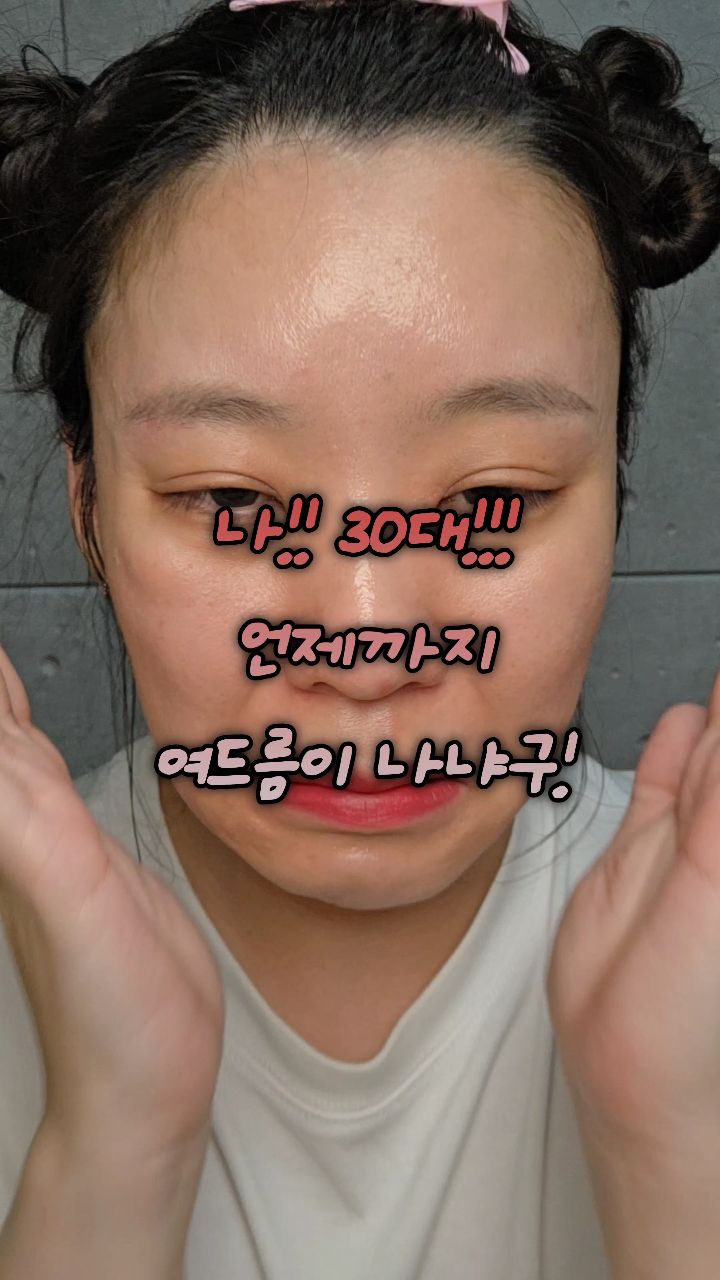 #광고 #메디티엔 #리커버리클렌징젤폼

📌청소년여드름에 특화된 포뮬러에요!
📌전성분 99% EWG 그린성분에 진정에 특화된 성분 위치하젤수가 함유되어있어요!
📌용량은 150mL 에서 200ml로 리뉴얼이 되면서 UP되었고
📌제약회사에서 제조한 제품이라 신뢰성까지 최고죠

🩷거품이 굉장히 풍성하고
🩷부드럽게 롤링되면서 촉촉한 마무리가 매력적인데요
🩷30초~1분정도 롤릴하는데도 눈이 전혀 시렵지 않더라고요.
🩷뽀드득 거리는 느낌이아닌 촉촉 그자체라는 점!

[메디티엔 리커버리 클렌징 젤폼]
✔️용량 200mL
✔️정상가 48,000원 판매가 32,800원
✔️펌프형이라 완전 편한건 비밀!

#메디티엔여드름세안제#여드름폼클렌징#여드름세안제#사춘기여드름세안제#청소년여드름세안제#여드름클렌저#클렌저#청소년여드름#사춘기여드름#화농성여드름#좁쌀여드름