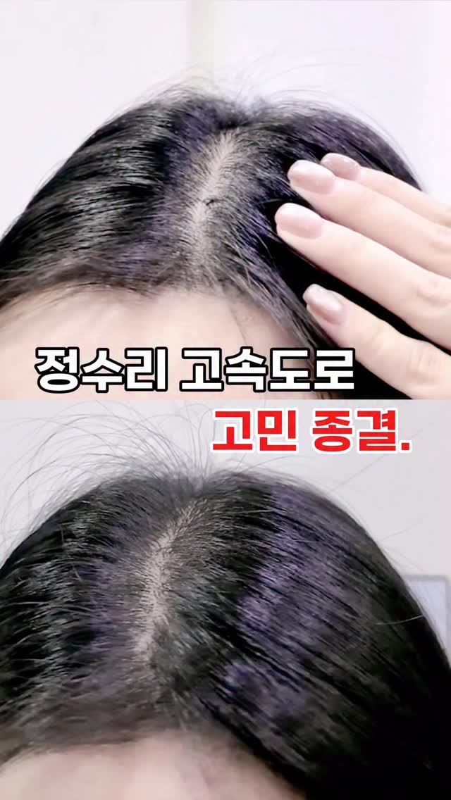 #광고 #레스노베 @resnovae_official 

늘 비어 보이는 정수리와 헤어라인
안 그래도 숱이 없어 걱정이었다면

탈모 예방 독자 성분 SCALPMEDIC™이
함유된 레스노베 엑스퍼트 샷 스칼프
앰플이 정답.ᐟ.ᐟ

모근부터 탄탄하게, 탈모 원인을 근본적으로
차단해 건강한 두피케어를 도와주는데요

사용도 간단, 무엇보다 전혀 떡지지 않고
산뜻하게 마무리되어 부담 없어요 :)

딱, 1회 사용만으로도 효과가 느껴지고
점점 정수리와 옆머리 볼륨까지 살아나
마음에 쏘-옥 들더라구요

평소보다 머리카락이 덜 빠지고
모발이 탄탄한 힘이 생기는 느낌 ?

빈 정수리, 탈모는 미리미리 레스노베
엑스퍼트 샷 스칼프 앰플로 관리해 보세요

#스칼프앰플 #두피앰플 #탈모케어템추천 #올인원케어 #두피케어 #두피쿨링 #두피탄력케어