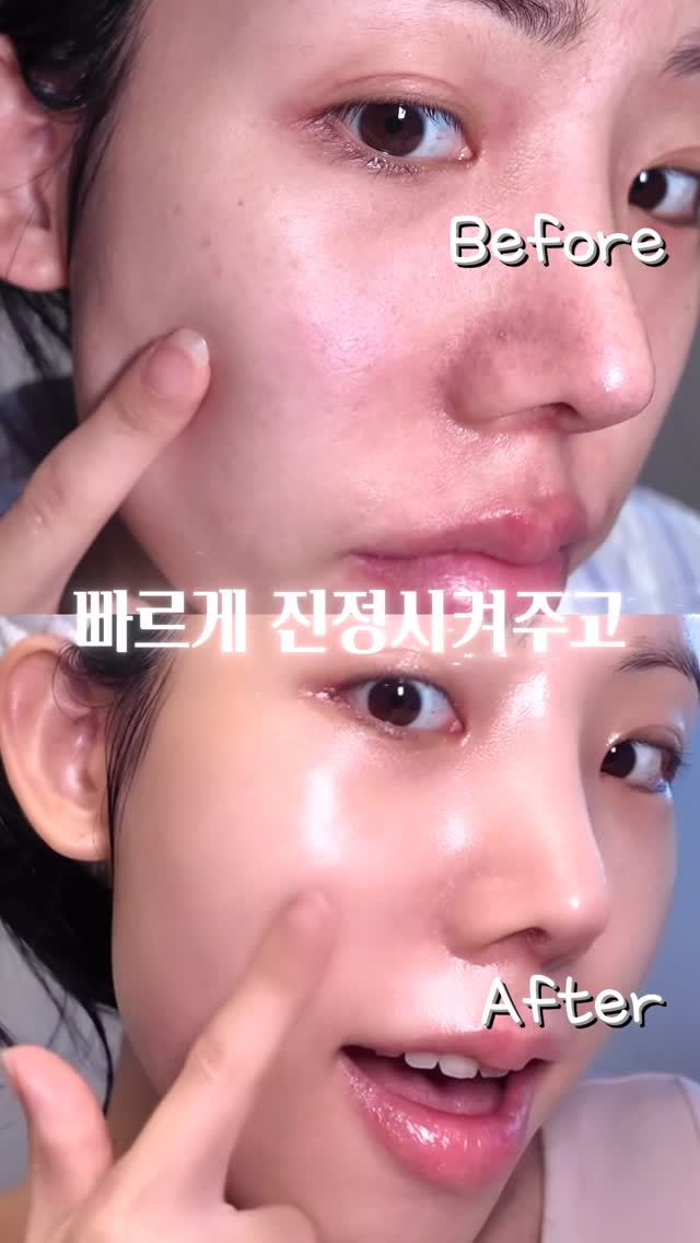 여행만 가면✈️피부 뒤집히는 사람?! 프로 여행러의 없으면 불안한 쿠팡추천템👍
네이처리퍼블릭 쉐어버터 스팀크림@naturerepublic_kr
건조하고 거칠어진 피부를 진정시켜주는 풍부한 고보습 크림으로,
장시간 촉촉하게 유지해줘서 완전 여행 필수템!
✔️공정 무역(페어트레이드) 쉐어버터 함유 → 피부 보습·영양 강화
✔️스팀 공법으로 제조 → 영양 성분이 피부에 더 깊고 촉촉하게 흡수
건조한 곳 어디든 사용 가능해서 온가족이 사용가능한 가족 전용 보습크림으로도 강추!(페이스 + 바디 겸용)
피부에 겉돌지 않고 부드럽게 스며드는 제형이고, 민감성·건성 피부도 사용 가능한 저자극 크림!
계절 변화, 특히 가을·겨울철 필수 보습템이니 미리 쟁여두세요 ㅎㅎ
합리적인 가격대 + 대용량 구성으로 가성비 짱!
#여행필수템 #기내필수템 #수분크림추천 #속건조크림 #쿠팡로켓배송 #쿠팡추천템 #쿠팡 #쿠팡여행템 #여행 #여행준비물 #고보습크림 #환절기크림 #환절기루틴 #보습크림추천 #가을크림추천 #겨울크림