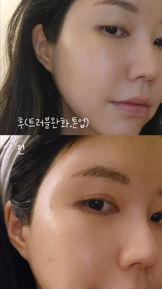 듀얼소닉 맥시멈은 초음파와 LED 라이트를
결합한 기술로 피부에 자극을
주지 않으면서 피부 속까지 침투해서
피부 개선에 도움을 줘요
⠀
요즘 트러블이 많았었는데 1주일동안
아침저녁으로 매일 cos-up모드를
사용하고 나서 얼굴이 톤업되고
피부도 촉촉해지고 진정되었어요.
⠀
이 모드는 초음파와 LED 라이트의
파장이 조화롭게 작용해서
피부에 탄력과 활력을 주고,
미백과 보습에도 좋아요.
⠀
저는 듀얼소닉 맥시멀을
사용한 지 1주일이 되었는데,
피부가 확실히 좋아진 것을 볼 수 있었어요.
트러블이 줄어들고,
얼굴이 밝아지고, 피부가 촉촉해졌어요.
⠀
5분이면 간편하게 관리할수있고
1달넘게 꾸준히 사용하다보니
얼굴에서 윤광이 돌아서
만족스럽게 사용하고 있어요:)
⠀
⠀
#듀얼소닉 #뷰티디바이스추천 #듀얼소닉맥시멈후기
#듀얼소닉서포터즈 #피부관리 #피부탄력
# 피부홈케어#미용기기 #피부관리기 #관리하자 #관리녀
⠀
⠀
⠀
⠀
