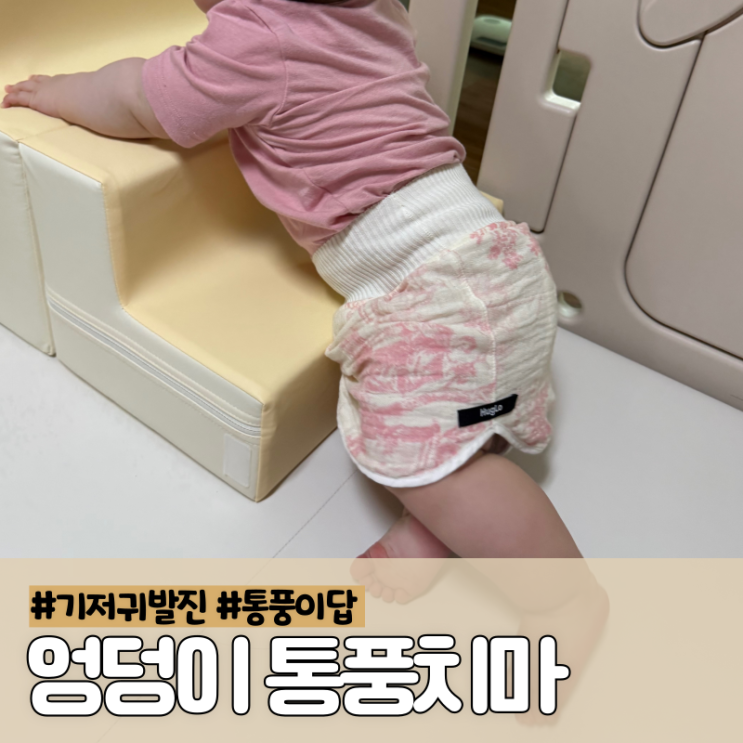기저귀발진 연고 비판텐 사용 대신 통풍 치마 입히고 해결