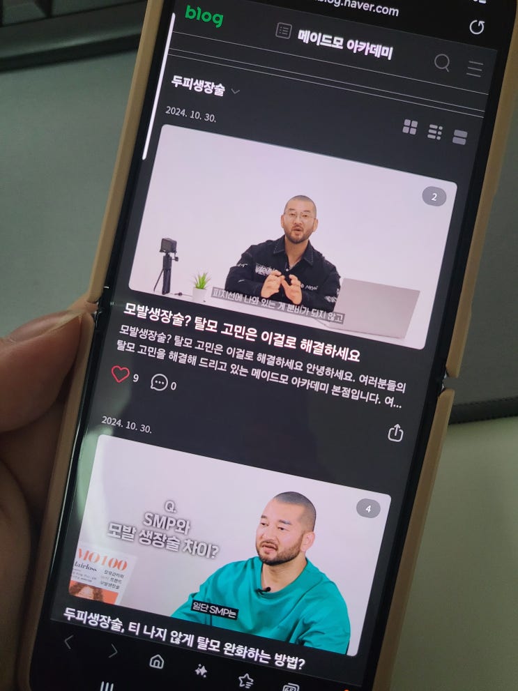 M자 헤어라인 교정 잘하는 메이드모아카데미 두피생장술