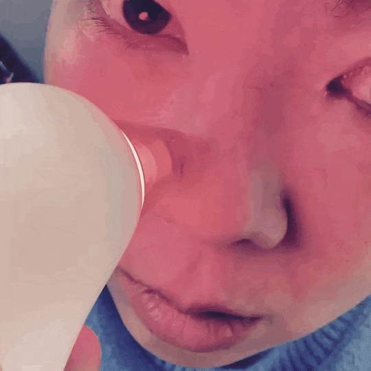 리뷰_ 피부 상처 없이 사용하는 멜리언스 모공 블랙헤드 제거, 피지제거기