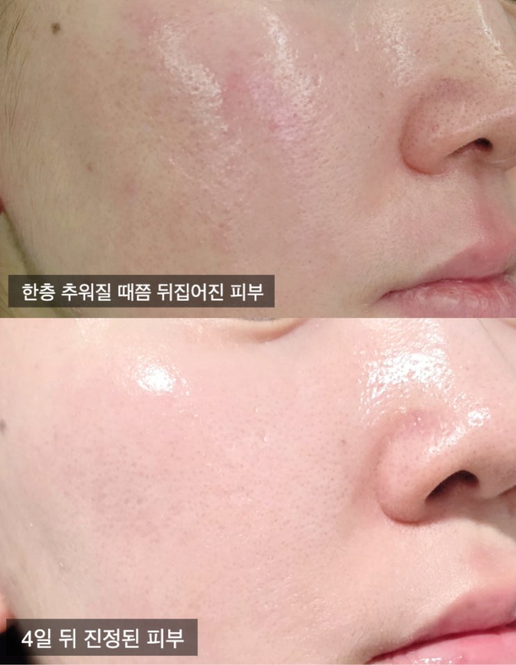 속건조 잡는 수분 장벽 토너 탈리다쿰 단델리온 에센스 수 찐후기