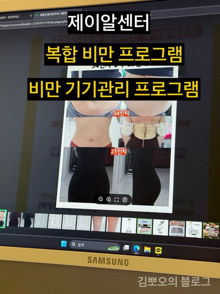 운동없이 편하게 받은 감량관리 후기｜서초동다이어트·방배동다이어트 제이알센터 💦