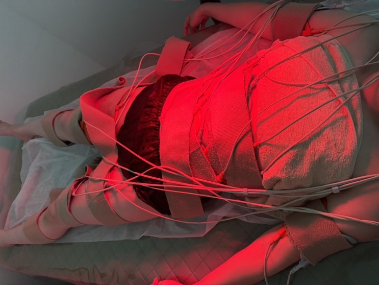 강남 비만관리 클리닉 제이알센터 고주파 ems 관리후기