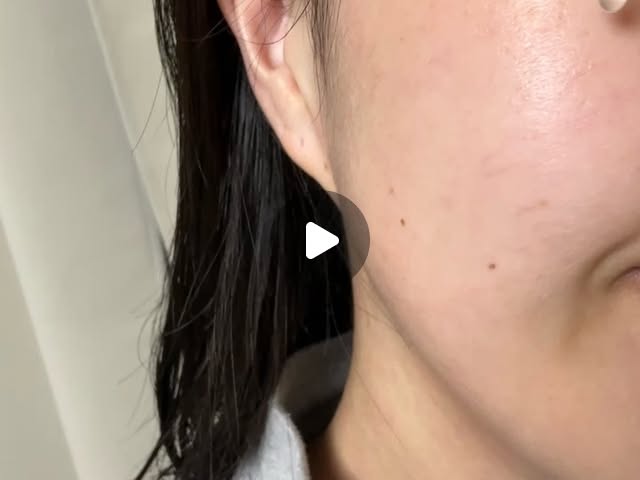 김혜영 on Instagram: "#광고

내 피부에는 좋은 것만 주고 싶잖아요 ✨
요즘 나인블랑의 신선한 고함량 순수 비타민C를 피부에 선물 중이에요 :)

두 아이 출산 후 올라온 울긋불긋 기미 때문에
늘 #기미앰플 찾아 쓰고 있었는데,
나인블랑 앰플 사용하고 나서 피부 톤이 한층 환해진 느낌이에요 🌿

23.5% 순수 비타민C 덕분에 자연스러운 광채는 물론,
데일리로 쓰기에도 부담 없는 제형이라 손이 자꾸 가요 💛

고함량이라 자극 걱정했는데
처음엔 살짝 따끔 — 비타민이 스며드는 느낌이라 오히려 안심!
마치 피부과 비타민 관리 받은 기분이에요 😊

아침·저녁 세안 후 토너로 결 정돈하고
1~2방울 얼굴 전체에 펴 발라주면 #나인블랑홈케어 끝 ✨

#나인블랑 #비타민C앰플 톤업케어 광채피부 홈케어루틴"