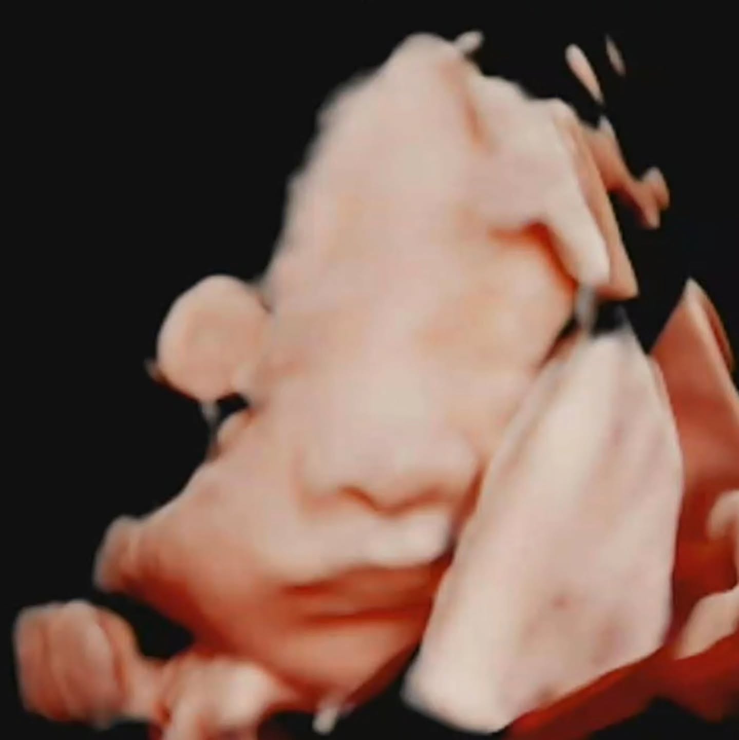 일년만의 근황 :)

24년 03월 결혼 후 
바로 찾아왔던 아가가 떠났어요

얼굴한번 못본 우리아가.. 얼마나 슬프던지
가만히 있어도 운전을 할때도 일하다가도
계속 눈물만 흐르더라구요 일상이 흔들릴 정도로

그래도 옆에서 남편이 많이 케어해주고
같이 여행도 가고하면서 마음이 한결 좋아졌을때

다시 아가가 찾아왔어요☺️

또 그렇게 될까 임테기 지옥을 겪고,
5주 3일 첫 초음파
아기집을 보고서야 안심이 됐는데
이후 계속된 출혈..

처음엔 근종때문에 그럴수도있다고 하셔서
제거수술을 했지만

7주쯤이었나 새벽에 화장실을 갔을때
피가 덩어리로 쏟아지더라구요

급하게 분만실에 야간진료를 갔더니
아기집 주변이 피고임으로 가득차있었어요:(
절박유산진단

급하게 한달병가를 쓰고
유산방지주사, 질정, 먹는약까지
아가를 지키기위해 최선을 다했고 
결국 한달뒤 무사히 복귀했어요

이후 12주 기형아 검사 고위험->니프티 검사 정상
중간 중간 계속된 이유없는 출혈
임신성 당뇨 재검
임신중독증 주의
조산위험이 큰 상태라 

쌤도 회사를 그만다니는게 좋겠다하시고
저도 더이상 왕복4시간씩 출퇴근은 무리라 생각해
지난 금요일 마지막 근무를 하고
연차+출산휴가+육아휴직에 들어가게 됐어요

31주라 출산까지 남은 날들이 많은데
저와 의사쌤의 목표는
아기 2kg 넘기기
36주까지 버티기라

바깥활동도, 연락도 한동안은 어렵지만
출산하고 좋은소식 가져올게요

그때까지 건강하세요!

한분한분 연락드리지못해 죄송해요🥲