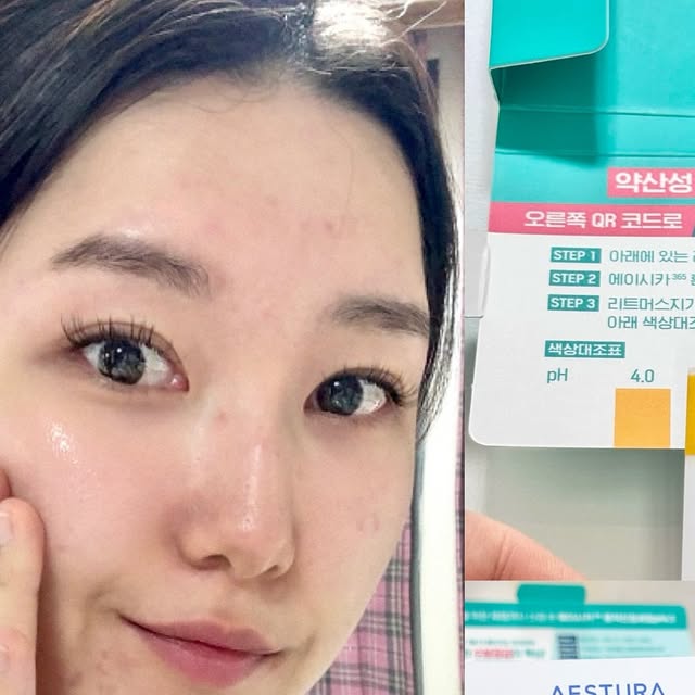 슬기 seulgi on Instagram: "#광고 #에스트라 #흔적진정세럼 
에이시카365 흔적진정세럼 
pH4.5 7일 체험 샘플링 KIT 사용해 봤어요~

📍민감피부, 이제 pH부터 확인하세요

리트머스 테스트 활용하여 샘플 사용 후 피부 pH 체크 가능한데 
손등에 진정세럼 얹고 테스트 하니 제 피부는 4.0pH
얼굴에 직접 테스트 해볼걸…!!!!

민감피부의 *붉은기는 일반 피부보다 
높아져있는 피부pH 때문에 3배나 더 붉어져요
제 피부가 *붉은기가 많은편인데 요즘 피부가 난리가 나서 장벽도 무너진게 분명합니다ㅠㅠㅠ

아래와 같이 이해하시면 쉬우실거에요
pH보호막 무너짐 > 장벽이 손상 > 손상된 장벽으로 외부 자극요인 침투가 쉬워짐 > 쉽게 *붉은기 발생
*외부자극에 의한 일시적인 붉은기

민감피부 특화 브랜드 에스트라가 찾은 민감붉은기에 최적화된 더마진정 솔루션 pH4.5CICA™
3D 그물망 구조에 pH4.5CICA™를 가둬 12시간동안 피부pH를 약산성으로 유지시켜줘요!

사용할수록 피부 붉은기가 관리 되는것 같아요 
> 사용 3일 후 일시적인 붉은기 76% 개선
> 사용 7일 후 불균일한 피부톤 2.7% 개선

민감한 피부이신분들은 공감하실거에요ㅠㅠㅠㅠ
계절이 변화할 때 붉은기가 올라오는걸…
이럴때 사용해주면 피부도 진정되고 붉은기도 가라 앉으니 딱이죵🤗💕

4월 올리브영 프로모션이 있으니 이때 쟁겨보자구욧
🛍️에스트라 에이시카365 흔적진정세럼 pH4.5 40ml+20ml 기획 (+에이시카 크림 1ml) 
> 40mL 본품 1개 + 20mL 추가 증정 + 에이시카 크림 1mL 샘플 증정
- 4월 동안 25% 할인
- 구매 URL 
https://m.oliveyoung.co.kr/m/goods/getGoodsDetail.do?goodsNo=A000000222839

@aestura.official 
#에이시카약산성세럼 #흔적세럼"