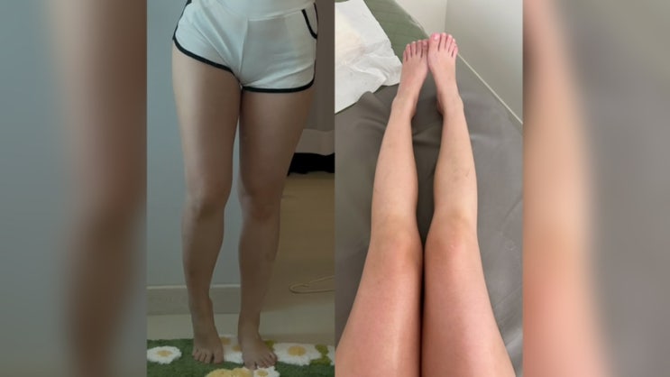 운동없이 다이어트…? 하체고민 해결해주는 하체슬리밍 후기 #서초동다이어트 #방배동다이어트