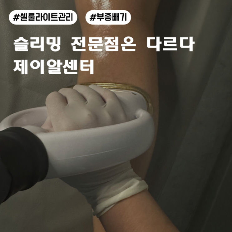 한 번으로 라인이 달라진 하체 슬리밍 관리 리뷰/서초동다이어트,서초동비만클리닉