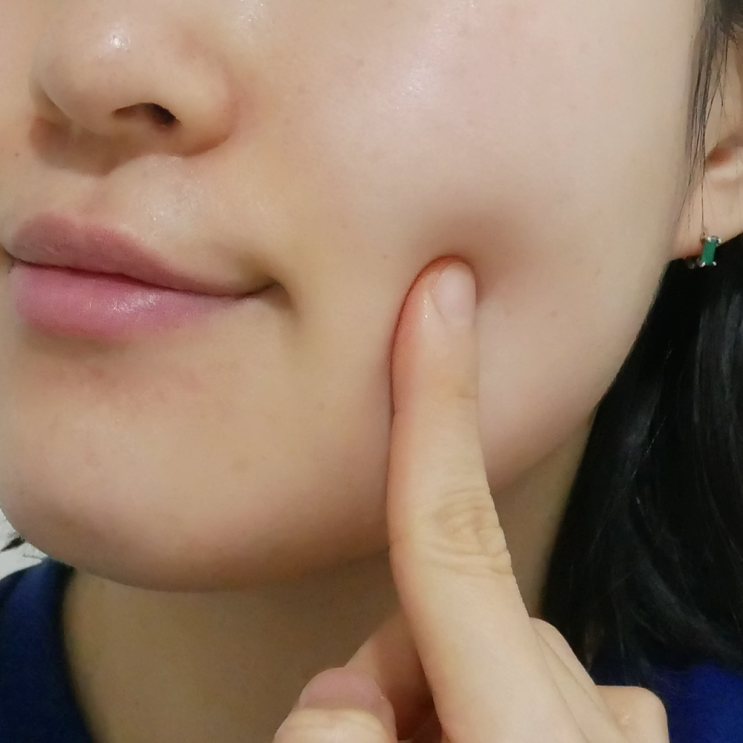 속건조개선이 필요할 때 선택한 포르셀 히알루론산 앰플