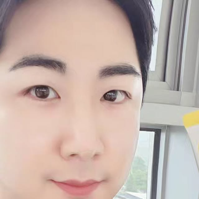 최보석 on Instagram: "#광고
.
.
.
#헬퓨 #콜린미오이노시톨 4000

전 원료가 100% 비건 인증 완료 ‼️

100% 식물유래 미오 이노시톨 
4,000mg 함유 💯 💯 💯 💯 

주석산수소 콜린 100mg, 레몬 추출 
엽산 🍋  활력 비타민 6종 함유 👍🏻 

첨가물&부형제 10 ZERO, NON-GMO

남성호르몬인 안드로겐이 많이 분비되면
피지과다 로 여드름의 원인이 될수있는데 
이노시톨은 안드로겐 수치를 낮추어 
탈모, 여드름 개선에 도움될수 있고

남성은 정자 운동능력을 향상시켜
수정률을 증가시키고 💪 💪 

여성은 성숙난자의 수가 증가하며
1등급 배아가 발생했다는 연구 결과가 있어
좋다고 하더라구요 👍🏻 👍🏻 🥰😍😘

인슐린 저항성을 개선시키기 때문에
혈당 조절이 필요한 당뇨, 지방간, 고지혈증 등의 
대사질환에 많은 도움이 된다고하니

남녀노소 추천드립니다 🤗🌞🌼💛💫

맛은 제가 좋아하는 깔끔한 레몬맛 이나서 
부담 없이 먹을수 있었고 🍋 
향도 바나나 향 같이 은은해서 🍌 
그냥 물없이 가루로 먹어도 괜찮았어요 ~~ 😋

#협찬 #헬퓨 #이노시톨효능
#미오이노시톨 #콜린이노시톨
#비건이노시톨 #이노시톨추천
#이노시톨4000 #임산부이노시톨
#생리주기영양제 #생리통영양제 
#협찬광고 #광고협찬"