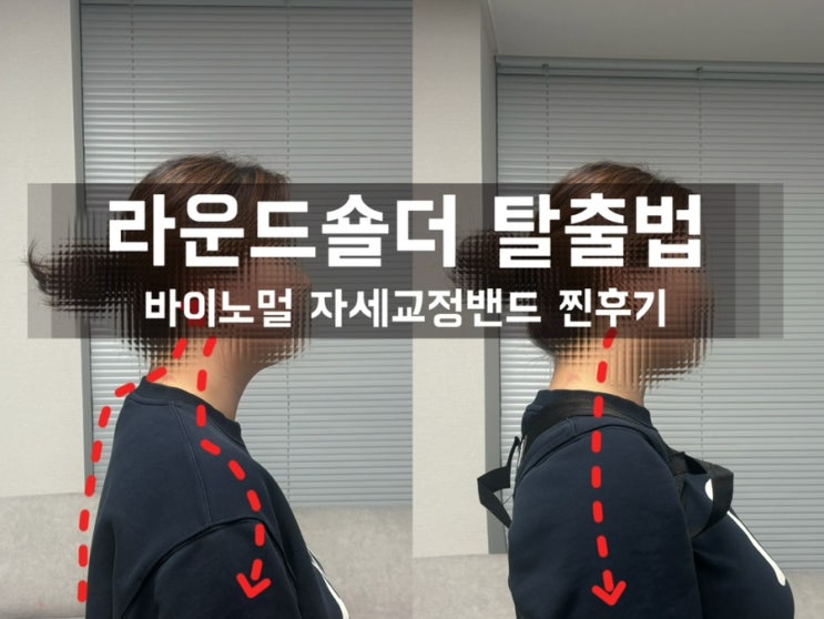 바이노멀 자세교정밴드로 거북목 탈출한 찐후기