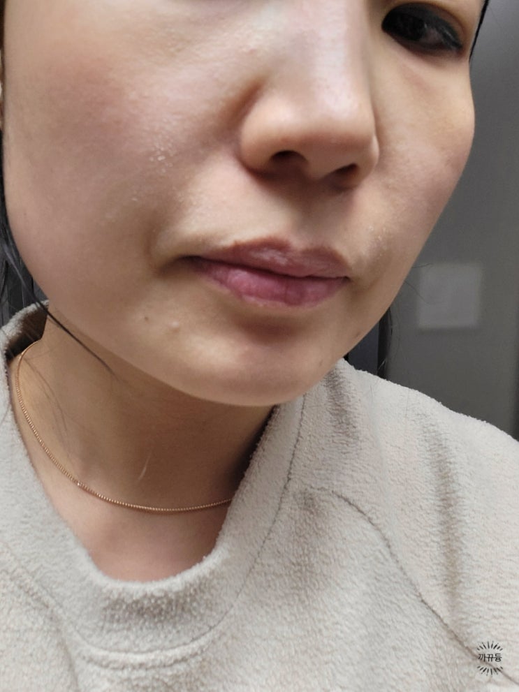 재생크림 미백주름 크림 완전 쫀득해요. [세플링엑소좀크림] 너무좋아서 엄마가 뺏어갔어요ㅠㅋㅋ