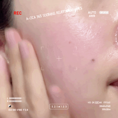 에스트라 시카세럼 흔적 진정을 넘어 붉은기 개선까지