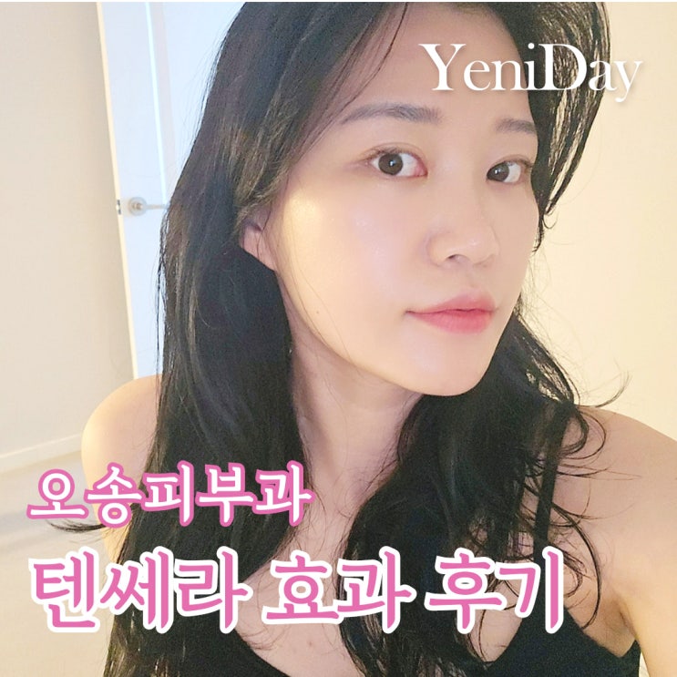 오송 피부과 텐써마 효과 통증 고현정리프팅 찐 후기