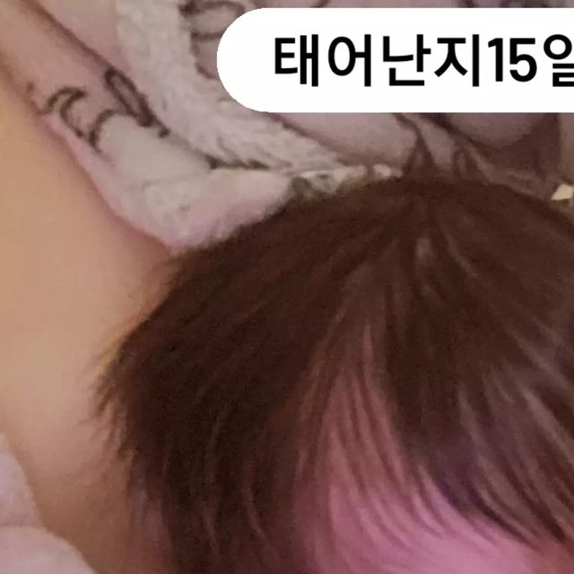 예비니 0118💕 on Instagram: "#제품제공 이지만 ㄹㅇ 찐 후기 

예빈이가 단두가 태어났을때부터 있었어요ㅠㅠ
(뱃속에서 짜부 되어서 태어났어요)
사경, 사두, 단두 다가지고 태어나서 저한테는 몰랐는데 다른사람들이 봤을때 심했나봐요 ㅋㅋㅋ 그래서 100일넘어 
교정베개를 사용했었는데 확실히 효과가 있긴하지만 더디더라구요? (｡•́︿•̀｡) (신생아때부터 교정베개 해줬으면 효과 더욱더 좋았을텐데 ㅠㅠ)

그런데 아이누오 베개를 좋은기회가 생겨 
반신반의 하면서 써봤는데 2주만에 효과가 있더라구요?
왜..그.. 알죠?? 지금 이시기가 애들 뒤집기하고 정면으로 잘 안누워있고 앉아있구 뒤집어져있고 그러잖아요 ㅋㅋㅋㅋ
예빈이도 그래서 에휴 진짜 효과 보는 베개여도 예빈이한테는 효과 없겠구나 하고 

일단 

분유먹일때, 누워서 놀때, 밤잠 옆잠베개로 재운뒤 베개 교체해서 재우고(사두때문에 옆잠베개로 자던아이라 일자로 절대 안자요..ㅋㅋㅋㅋㅋ)

이과정밖에 안했어요 그래서 누워있는시간이 적어서 효과 없을줄 알았는데 잉? 몇일동안 몰랐는데 어느순간 
조금씩 나오더라구요 그래서 뭐지... 했는데 16일 딱 2주 되는날
사진 비교해서 보니깐 진짜 튀어나오긴 했더라구요 ㅋㅋㅋㅋㅋ

솔직히 늦은감이 없지않아 있잖아요..지금 예빈이가 오늘기준 18일 딱 6개월 됐는데 
효과있는거보고 쫌 많이 놀랬어요 ㅋㅋㅋㅋ 

*** 이런 분들있을까봐 적어요 
앉아있는 시간이 길어지고 안누워있으면 뒷통수 나오잖아 그래서 그런거 아냐? 이러실수 있는데 

예빈이는요 오래 의자에 앉혀놨구 누워있을때는 무조건 
두상교정베개 써서 눕혔구요 신생아때부터 사경때문에 옆으로 눕혀서 재웠어요...그런데 보시다시피 104일차 사진보면 교정베개 안하고 옆으로 만 재웠는데도 
납작한거 보이시죠..?😢😢😢

그러고나서 교정베개 써서 튀어나온게 167일 

저 사진이구 그뒤로 

그 기존에 쓰선 교정베개 말고 아이누오 써서 2주만에 

저렇게 튀어나온겁니다

한마디로 2주만에 앉아있고 뒤집어져 있는다해서 저렇게 
튀어나오지 않는다 이말이에요!!♥(〃 ´з`〃 )♥

그리고 신생아때부터 심각하다고 인지했을때 사진과같이 현재 뒷통수 나온거 못믿으실까봐 동영상도 첨부했어요ㅋㅋ♥

아이누오 장점이!

❄ 베개가 엄청 시원해요 ㅋㅋㅋㅋ 태열도 자주 오르고 
  몸에 열이많아 잠자면서 땀도 많이 흘리는데 베개가
  시원하다보니 좋은가봐요♥ 

❄ 양 옆에가 볼록 하다보니 잘자요! 얼굴을 막
  엄청 움직일수가
  없다보니 베개를 교체해도 잘 자더라구요😆

❄ 신생아부터 가능해요!!♥*♥ 

❄ 효과가 있다 (하지만 더 뒷통수가 나올수있는지 
  없는지는 지켜봐야 알것같아요)

🌟 아직까지 단점은 모르겠는데 깨어있을때 뒤집기를 하다보니 제대로 누워있지않고 탈출해서 빙빙돌기 바빠요 ㅋㅋㅋㅋㅋㅋㅋㅋㅋㅋㅋ
(˃̣̣̣̣̣̣︿˂̣̣̣̣̣̣ ) 

저처럼 짜부가 되어서 태어났거나 아님 
정면으로 많이 눕혀서놔서 납작해진 아가들 
저처럼 후회하지말구 최대한 신생아일때부터 늦어도 100일안에는 두상베개 해줘요♥ 

강추합니다!!!!♥ 아이누오 피트 쿨쿨 베개♥

#광고#아이누오#아기베개#아이베개#유아베개#두상베개#아이두상베개#아기두상베개#아기베개추천#아이베개추천#아이경추베개#아기경추베개#출산선물#육아선물#육아템#육아추천템#육아템추천#신생아베개#신생아베개추천#임신선물#임신축하선물#아이누오아기베개#짱구베개#통잠베개#inuo#태열베개#아기여름베개#신생아여름베개#신생아태열베개"