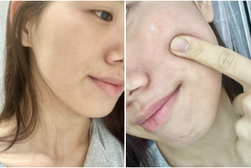 김희선x한혜진x진서연 주연 다음생은 없으니까 보습앰플 어디꺼? 엘라비에 멜라리턴 래디언스 앰플