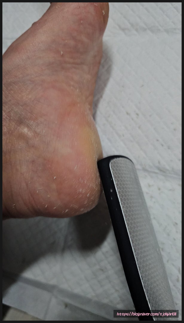 환절기 필수템 바렌 발각질제거기 발각질연화제로 까칠했던 내 발 뒤꿈치 싹 정리했어요