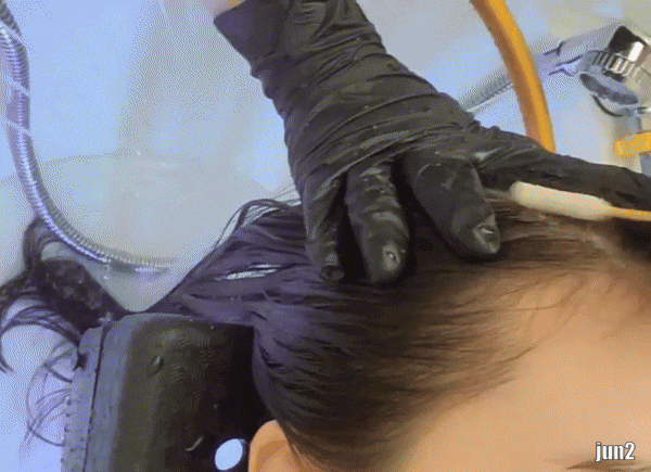 [노원] 리메디뷰티 #노원역윤곽리프팅 #노원역헤드스파 #노원역버섯증후군 #노원역승모근웨딩라인만들기