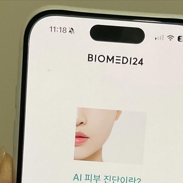 🍰 on Instagram: "#바이오메디 #AI피부진단 #AI피부분석"