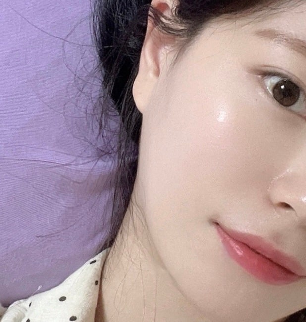 { 신논현역 피부과} 리즈네 스킨부스터 후기,가격,엠보,자국