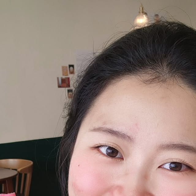 루쓰 | 뷰티 | 여행 | 일상 | 맛있는거 ❤️ on Instagram: "#광고
🍓💖 요즘 내 필수템 #베리베리화이트 스틱젤리 🥰
상큼달달한 맛으로 하루 기분 업!🍓✨
먹는 순간 기분까지 화사해지는 느낌?
그냥 맛있기만 한 게 아니라, 속부터 화이트닝을 챙길 수 있는 이너뷰티템이라 더 마음에 들어요💫

글루타치온 + 비타민C로 피부 톤업, 항산화까지 한 번에!
스틱형으로 간편하게 쏙쏙 챙길 수 있어서 피부관리 루틴에도 딱 맞아요
출근길, 운동 후, 카페 타임… 언제든 습관처럼 톡톡!
내 피부가 속부터 밝아지는 걸 느낄 때마다, 이거 진짜 셀럽템 인정 😎

💬 “맛있게 먹으면서 미백까지 챙기는 거 실화냐?” 하고 주변 친구들이 물어볼 정도에요
이제 간편하게 미백 루틴 일상만들어요💖

#베리베리화이트#화이트닝젤리#미백스틱젤리#글루타치온젤리#먹는미백#뷰티젤리#비타민C보충#미백템#피부톤업#피부미백#이너뷰티템#스틱형건강식품#피부관리루틴#간편미백"