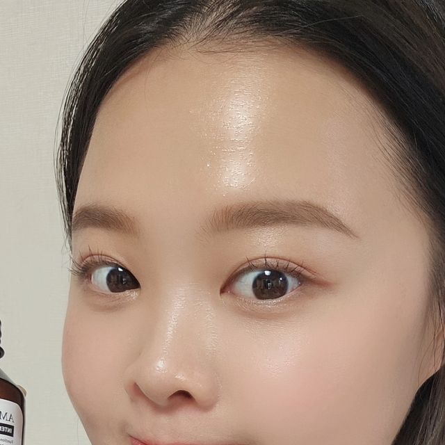 장햅삐 on Instagram: "#광고 지만 좋네요..ㅎ
모발의변화 : 7번사진이 전 // 8,9번사진이 후
ㆍ
저는 진짜..중딩때부터 고민이 두피였던것같아요..두피뾰루지 저만 나는거 아니잖아요ㅜㅜ??진짜 저는 두피뾰루지 진짜 달고 살거든요? 현재도 한두개는 있어요..완치는 없을것같다고 해도 진짜 줄긴 하더라구요!? 그리고 두피건강에 도움이되는 실천도 해야해요!
부티나고 우아한 모발은 윤기에서 난다고..찐부자들은 모발건강에 힘을 쓴다는 소리를 들어봤는데 진짜 중요한관리가 모발관리인것같아요! 두피가 건강하면 모발은 따라올텐데 ... 
그래서 들고왔어요 윤기있고 튼튼한 모발의 비밀!!
인디안 구스베리성분이 들어간 비밀스러운 성분으로 윤기있는 모발로 가꿔준다는 그런 성분인데 자체 개발된 특허청 인증 성분으로 탈모완화 집중케어를 할 수 있는 제품이예요!!

트리트먼트 두피에 잘못사용하면 진짜 뾰루지 대참사가 일어나는데 미라클레어 암라리치 인텐시브 두피케어 스칼프 트리트먼트는 달랐어요! 두피 피부 저자극 테스트 완료한 제품이라그런지 두피에 자극이 정말 안갔나봐요! 
미라클레어 암라리치 인텐시브 두피케어 스칼프 트리트먼트는 모발 탈락수 감소와 볼륨테스트까지 완료했고 유해물질 20가지가 불포함된 제품이예요!

진짜 두번 써봤는데 즉각적인 효과가 좀 보여지고 두피까지 맘데로 발라도 되니까 너무 편해요!! 전 짧은머리라 모발에만 바르는것도 어렵거든요??씻겨낼때 아무래도 ..두피에 닿아요;; 그래서 뾰루지들이 났던것 같은데 이건 1~2개는 원래 열이 많아서 나는거라 생각하면 전혀 아프지가 않음!! 그리고 머리감고 제발 머리 먼저 말려주세요..그래야 두피뾰루지가 덜 올라오더라구요!
제가 화장 다하고 머리 말리는 습관이 있었는데 그러면 안됌!!!

여러분들도 두피관리 잘 해보세요! 삶의 질이 좋아짐!

#미라클레어 #트리트먼트 #여성탈모 #임산부탈모 #miraclair #탈모예방 #탈모완화 #두피케어 #가려운두피 #헤어팩추천 #헤어영양제 #헤어트리트먼트 #헤어마스크 #트리트먼트추천 #헤어트리트먼트추천 #모근강화 #손상모 #손상모헤어팩 손상모트리트먼트 #홈케어헤어팩 #클리닉헤어팩 #극손상헤어팩 #두피각질 #두피관리 #두피트러블"