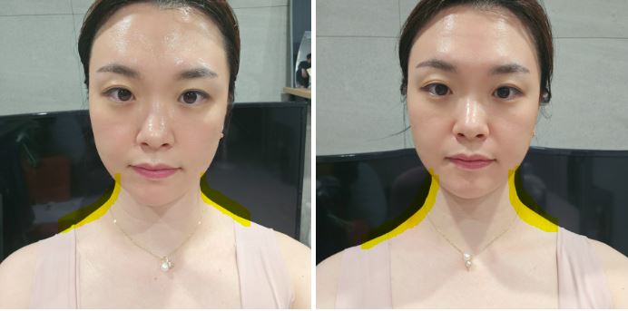 무선 목 어깨 마사지기 이로위로로 승모근관리 한 큐에 해결했어요