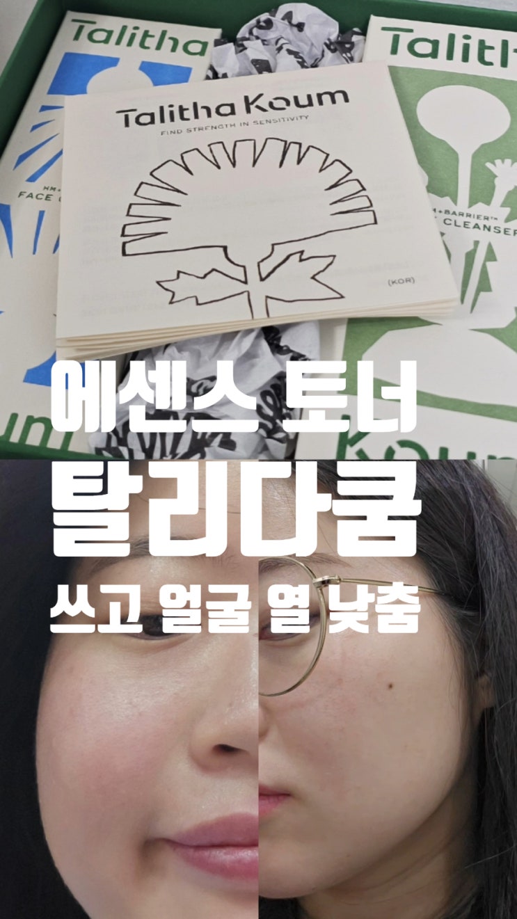 에센스 토너 탈리다쿰 쓰고 얼굴 열 오를 때 낮춤