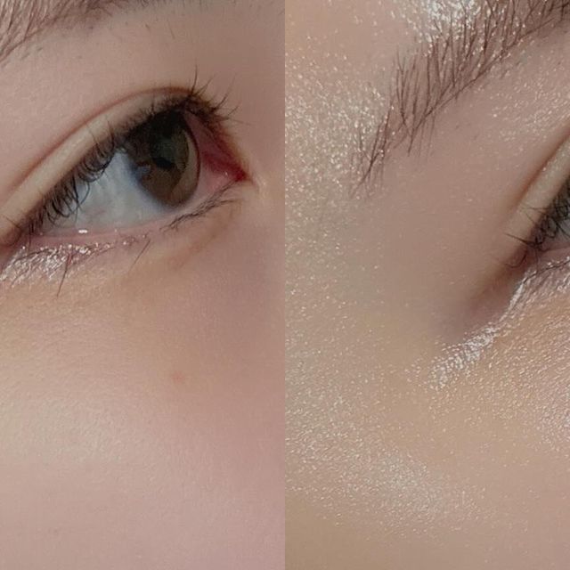 @yun_eevee on Instagram: "#협찬 
⭐️ FDA인증 화장품 ⭐️
제품명: 닥터윤스 뉴로바이오 오토파지 레볼루션 크림
구매링크: https://item.gmarket.co.kr/Item?goodscode=3642523480

🍂 피부가 거칠고 당긴다면
👵🏻 깊어진 주름이 고민이라면
👩🏿 어두워진 피부톤을 밝히고 싶다면
💧 겉부터 속까지 고보습을 원한다면
😎 탄력있는 피부가 되고싶다면

노벨상을 수여받은 오토파지 시스템으로 세포의 건강한 상태를유지해준다고 해요. 장수 유전자로 이루어내는 뛰어난 항산화효과와 헥사펩타이드 성분으로 성장호르몬 분비를 촉진해주어 젊은 피부로 재생을 도와줍니다.

500달톤 이하 초저분자 콜라겐과 히알루론산이 반응하여 피부주름 고민 없이 고탄력 피부로 돌아가보아요! 독보적인 마이크로 바이옴 기술의 천연물 유래 효소 화합물이 함유되어 더더욱 탄력있는 피부가 될 수 있습니다.

오토파지는 독소를 제거해주어 항염증 작용까지 되니 치유과정이 된다고 합니다. 콜라겐 트리펩타이드가 15%, 150,000ppm 이상 고함량 함유되어 초저분자 콜라겐과 히알루론산이 피부주름과 탄력을 케어하기에 딱이겠죠? 
•
•
•
#주름개선 #주름개선화장품 #수분크림 #보습크림#오토파지크림 #오토파지레볼루션크림 #기능성화장품 #미백크림 #FDA인증화장품 #화장품선물 #바이오화장품 #다기능화장품 #화장품선물 #엔에프씨생명과학 #창과창"