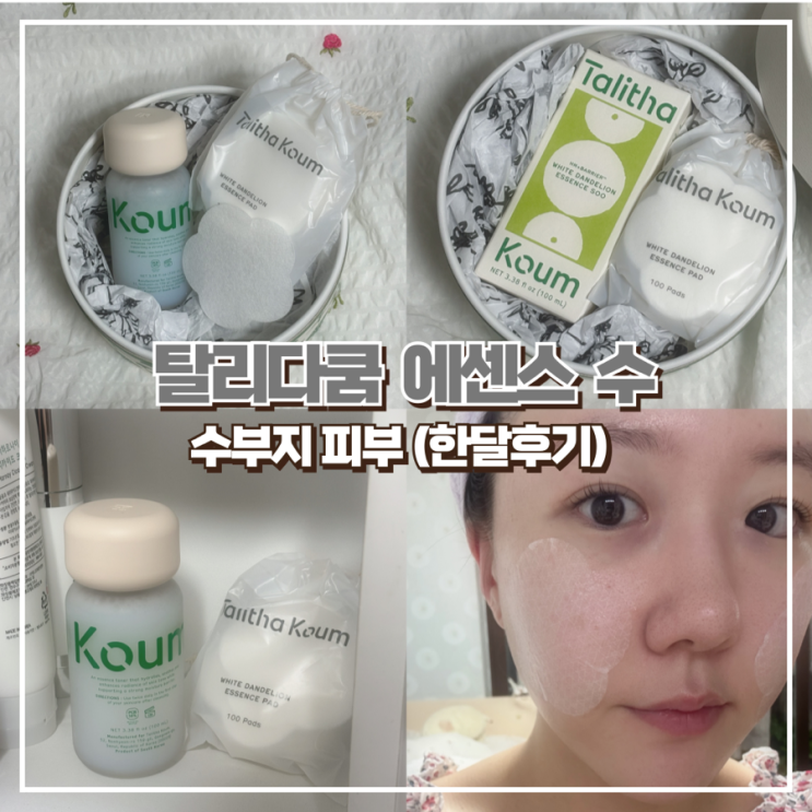 민감성 피부 스킨 추천, 탈리다쿰 에센스 수 (한달후기)
