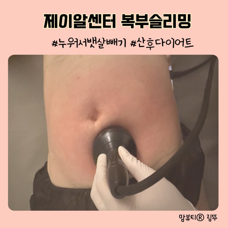 산후다이어트 누워서 뱃살빼기 프로젝트 제이알센터 복부슬리밍 후기