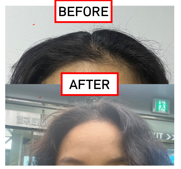 향좋은 탈모샴푸 피그 블로섬 토탈 스칼프 샴푸