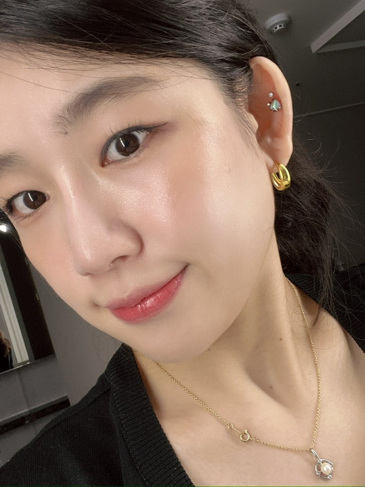 동탄피부과 30대여자 세렉소(Celexo)엑소좀 스킨부스터 1회 후기